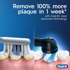 ელექტრო კბილის ჯაგრისი Oral-B iO 5